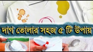 কাপড় থেকে ৫ রকম দাগ তোলার সহজ উপায়
