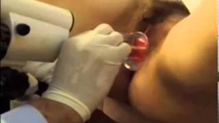 DEMOSTRACIÓN DE TOMA DE MUESTRAS DE PAPANICOLAU