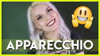 Apparecchio fisso la mia esperienza + consigli | BarbieXanax