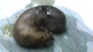 HACEN VOMITAR GUSANOS A MUJER SUPUESTAMENTE HECHIZADA
