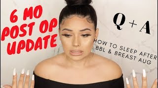 How To Sleep After BBL & Breast Aug + 6 Month Post Op Update ++ Q&A