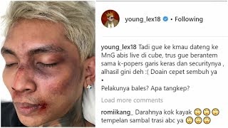 Young Lex Babak Belur Dikeroyok Fans K-Pop Garis Keras? Kata Netizen "Cuma Make Up."