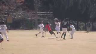 【アンプティサッカー】元ブラジル代表ヒッキの超絶「股抜き」ドリブル！Amputee Football great dribbling skill！