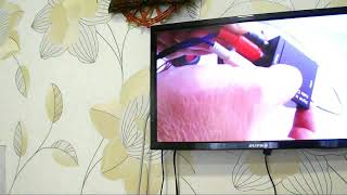 Подключение колонок к телевизору Supra Smart TV