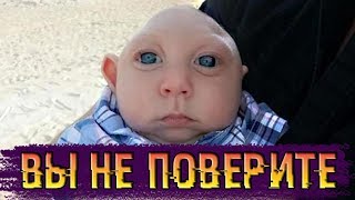 Помните мальчика, который родился без головного мозга? Вот как он живет теперь ...