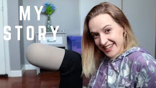 HOW I BECAME AN AMPUTEE - The real story [CC]