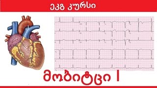 ეკგ კურსი -  მობიტცი I / მეორე ხარისხის ატრიოვენტრიკულური ბლოკადა (მობიტცი პირველი)  მობიცი I