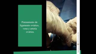 Mastectomia y Ovariectomia en Gata