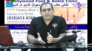 Cavus / High Arch Foot            قوص زیاد پا