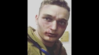 Эдварда Била избили 2019(не постанова)Edward Bil получил/ драка/неудачный пранк/