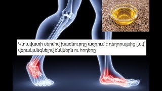 Կտավատի սերմով խառնուրդը ազդում է դեղորայքից լավ՝ վերականգնելով ծնկներն ու հոդերը