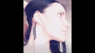 Как я вылечила ГИПЕРТИРЕОЗ БЕЗ ТАБЛЕТОК И ГОРМОНОВ!(+анализы до и после!)Метод Савинова!