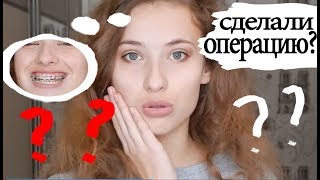 ЧТО СО МНОЙ СЛУЧИЛОСЬ???