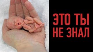 10 НЕОЖИДАННЫХ ФАКТОВ ПРО АБОРТЫ