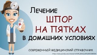 Шпоры на пятках лечение в домашних условиях. Как лечить шпоры на пятках народными средствами.