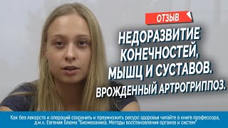 Марк Патрикеев - пациент с артрогрипозом