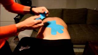 Kinesio-Tape bei Rückenschmerzen