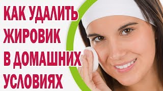 Как удалить жировик в домашних условиях