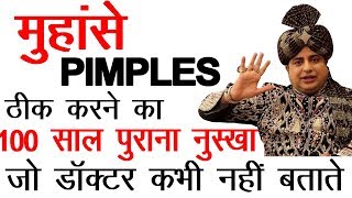 How To Get Rid of Pimples & Acne ''Permanent Solution'' : Sanyasi Ayurveda