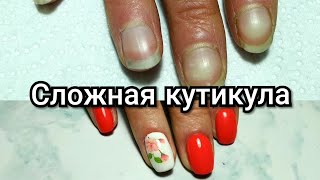 2 часть. Сложная кутикула. Укрепление полигелем.
