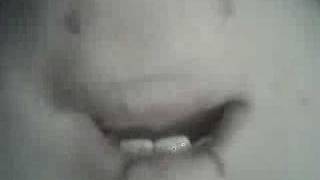 The Emo Chin!!DunDun Dunn!!!