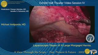 Laparoscopic Repair of A Large Morgagni Hernia