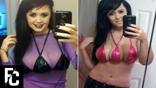 10 People With EXTRA BODY PARTS | LIST KING