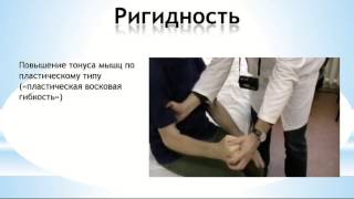 Болезнь Паркинсона