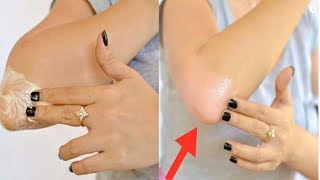 طريقة تبييض و علاج سواد الركب بأمان