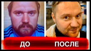 Алкоголизм До и После! Мой опыт 4 года и 5 месяцев без спиртного! Результат на лицо!