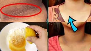 COMO BLANQUEAR TU CUELLO/ EN CASA TU MISMO EN 2 DIAS( FUNCIONA AL 100%.