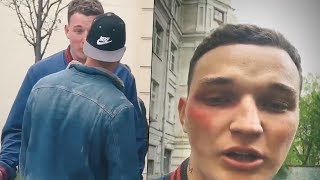 КАЧОК УДАРИЛ ЭДВАРДА БИЛЛА В ЛИЦО