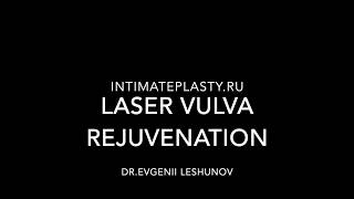 Laser vulva rejuvenation by Er:YAG laser