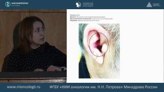 Анамнез заболевания пациентов подготовленных для провдения криохирургического лечения