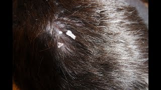 Removing dandruff with a toothpick?!