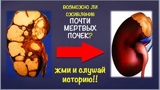 Оживают ли ПОЧТИ МЕРТВЫЕ ПОЧКИ? Да! И в Германии тоже...