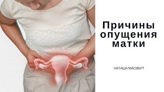 Из-за чего происходит опущение матки