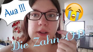 Meine Weisheitszahn-Geschichte | Kathy@Home