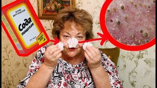Как убрать черные точки на носу содой