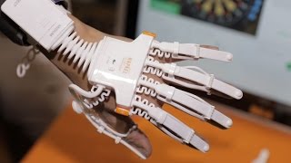 You wear it like a NES Power Glove, but it's all about rehab