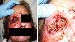 5 САМЫХ УЖАСНЫХ ПАРАЗИТОВ