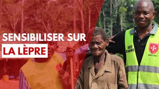 Lutte contre la lèpre : la sensibilisation des populations au Congo