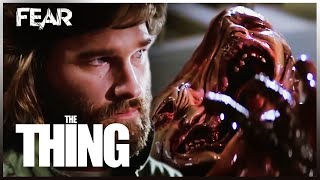 The Alien's Autopsy | The Thing (1982)