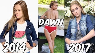 Nicky, Ricky, Dicky & Dawn Before And After 2017
