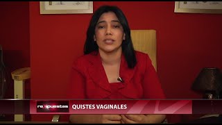 Quistes vaginales