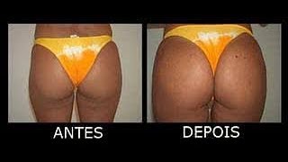 como aumentar bumbum e perna em apenas uma semana