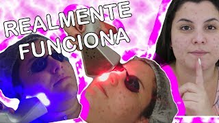 ADEUS ESPINHAS !!!! TRATAMENTO EFETIVO | Julia Martins