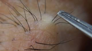 La depilación para el cuidado de la piel de la chica de belleza 006. con microscopio