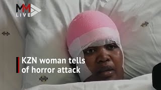 KZN woman speaks of horror knife attack which left her armless