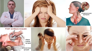 Синдром позвоночной артерии | Vertebral artery syndrome